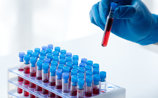 Hand stellt Blutreserve zu 48 Behältern für spätere Analyse.