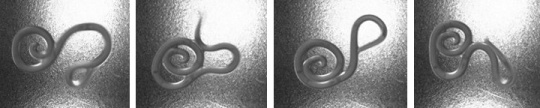 Verschiedene Krümmungsszustände einer einzelnen Nematodenlarve innerhalb 2 Sekunden