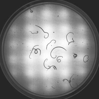 Nematodenlarven (Anisakis spp.) unterschiedlicher Vitalität aus einer Gewebeprobe (Durchlicht (NIR)/ Petrischale)