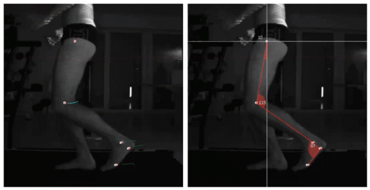 GIF einer Person, von der die Beinbewegung gemessen und untersucht wird.